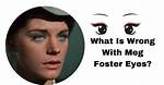 Is Something Wrong with Meg Foster Eyes? Mutation or Genetic Defect
