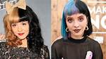 Melanie Martinez: Plastic Surgery Rumors Unraveled