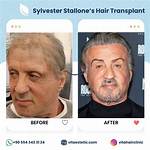 Sylvester Stallone's Iconic Hair: a Look Back at the Legend