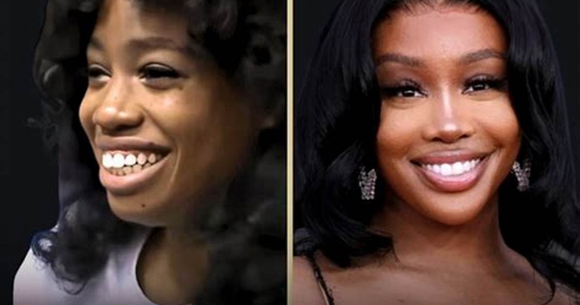 Sza's Plastic Surgery Journey and Its Impact